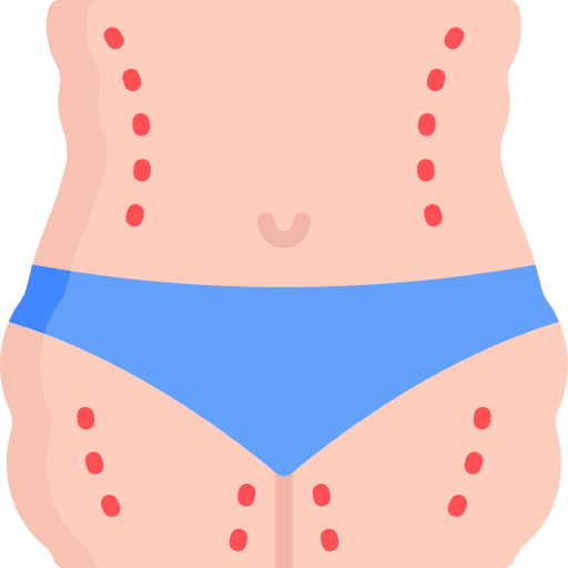 Liposucción