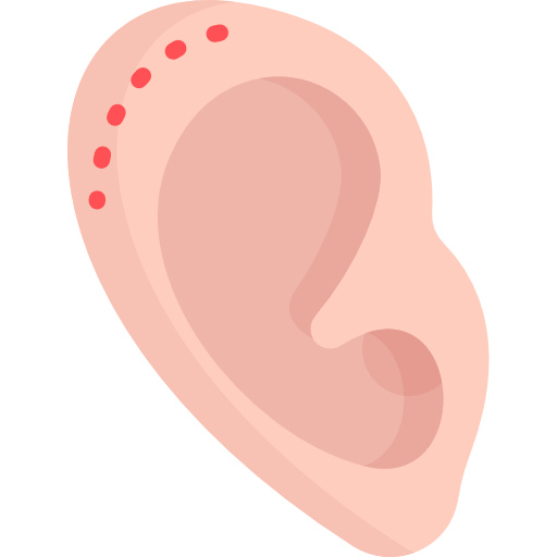 Otoplastía