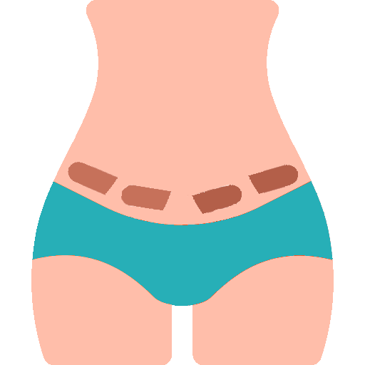 Abdominoplastía o Tummy Tuck