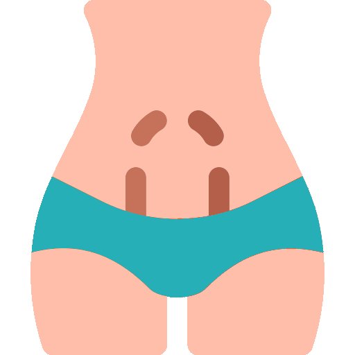 Miniabdominoplastía